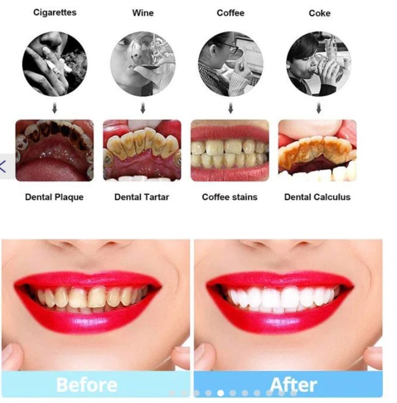 Dental9