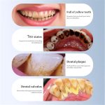 1a374ef1 1590 44aa B16f Db5f5c69ab36 Sonosparkle Teeth Cleaner 31 000 Vibrations Per Minute 5 Mod 6 2.jpg