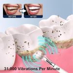 Bf40ce77 5805 4fc0 9ec9 64a9dd311d2f Sonosparkle Teeth Cleaner 31 000 Vibrations Per Minute 5 Mod 4 2.jpg
