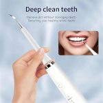 D373c5d9 Abb3 4573 9bce 48aa977aacd8 Sonosparkle Teeth Cleaner 31 000 Vibrations Per Minute 5 Mod 3.jpg