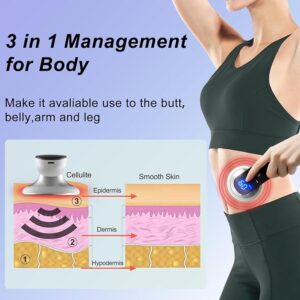 9fa2c27b 690a 407b 9e87 e7e8b494f9fe body shaping fat burning device cellulite stretch mark massa 4 5.jpg