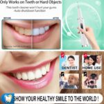 24c1e197 f3db 4e47 bb97 3630c48374b5 professional plaque remover contact activated teeth cleaning 3 1.jpg
