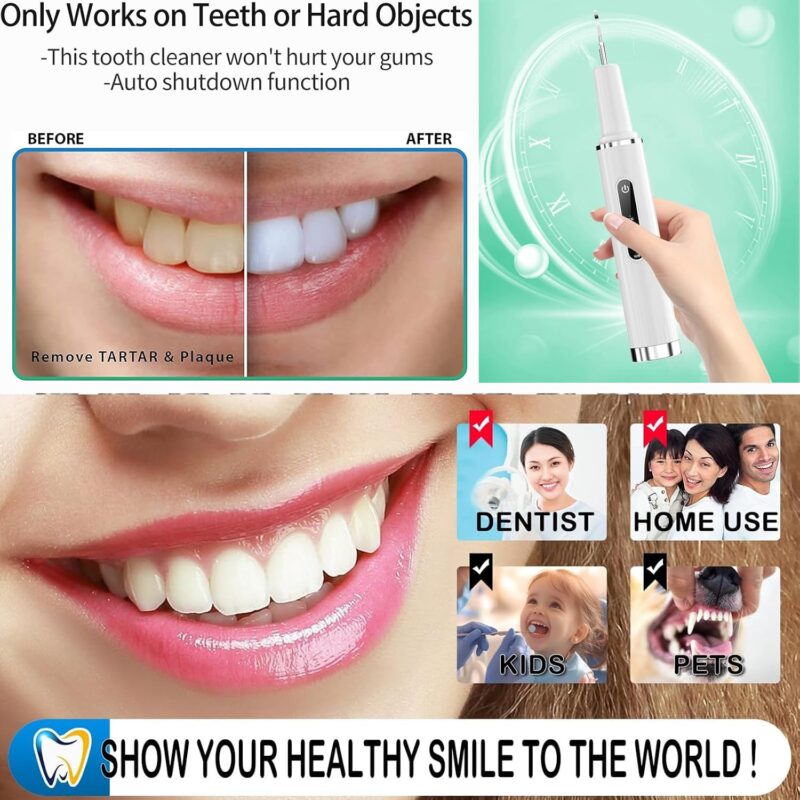 24c1e197 f3db 4e47 bb97 3630c48374b5 professional plaque remover contact activated teeth cleaning 3 1.jpg