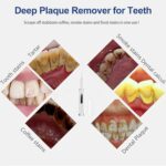 5be58384 03e0 41bb a917 2d447d961f3d professional plaque remover contact activated teeth cleaning 6 1.jpg